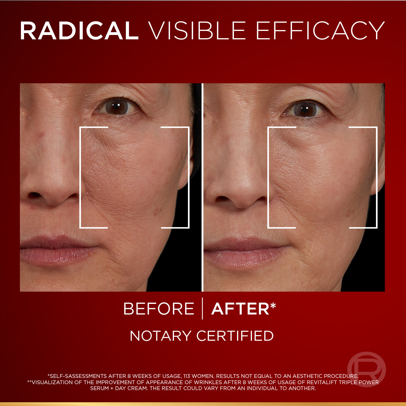 L'Oréal Revitalift Triple Power Anti-Aging Serum 30ml bottle - 5