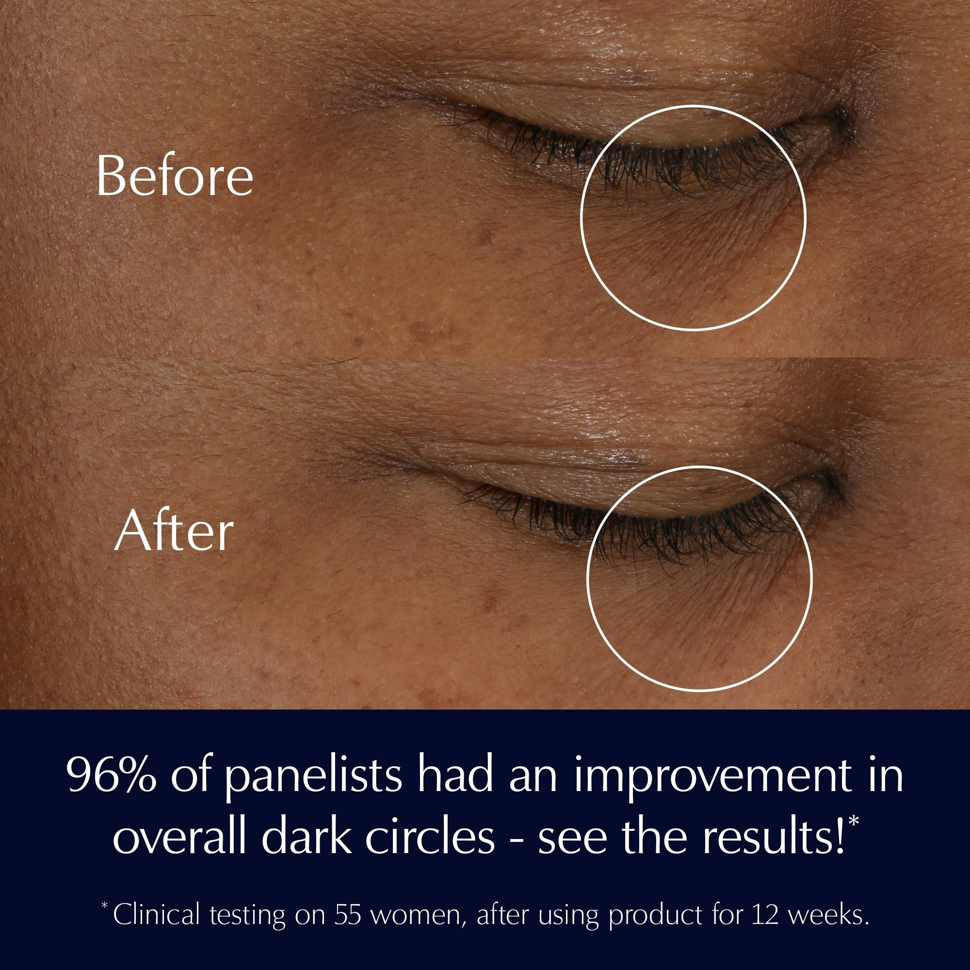 Advanced Night Repair Eye Cream Skincare Set Repair + Brighten + Hydrate
