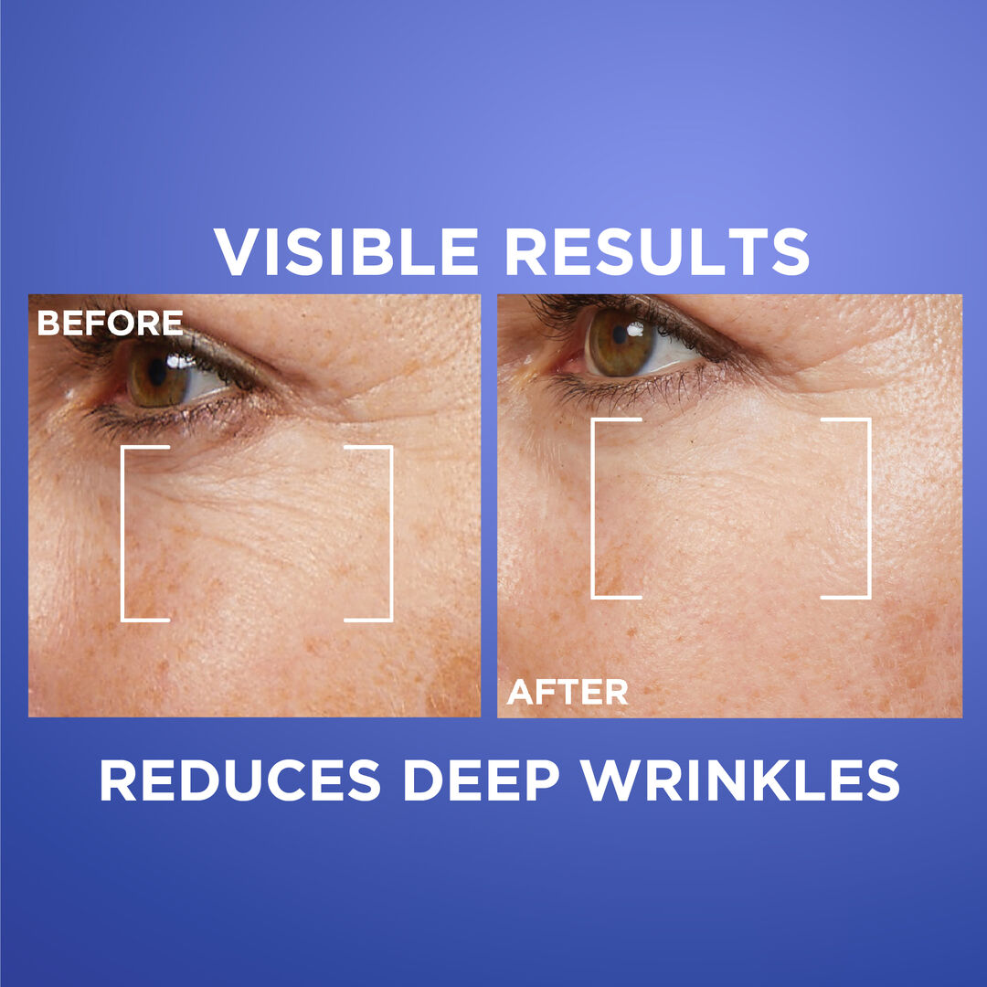 L’Oréal Revitalift retinol night serum 0.2 percent 30ml for deep wrinkles and anti aging