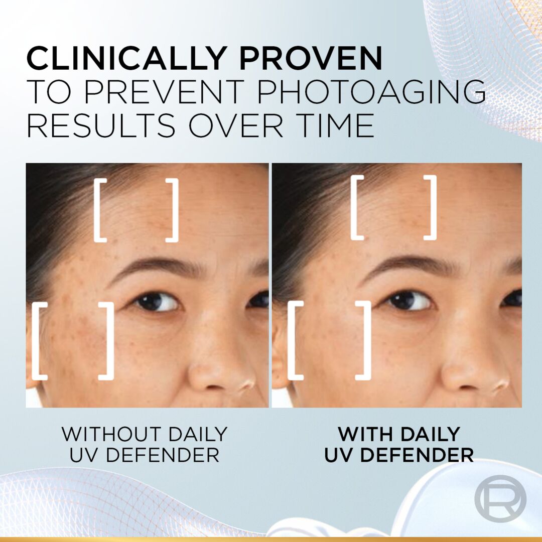 Before and after comparison of facial skin with and without daily UV defender, clinically proven to prevent photoaging.